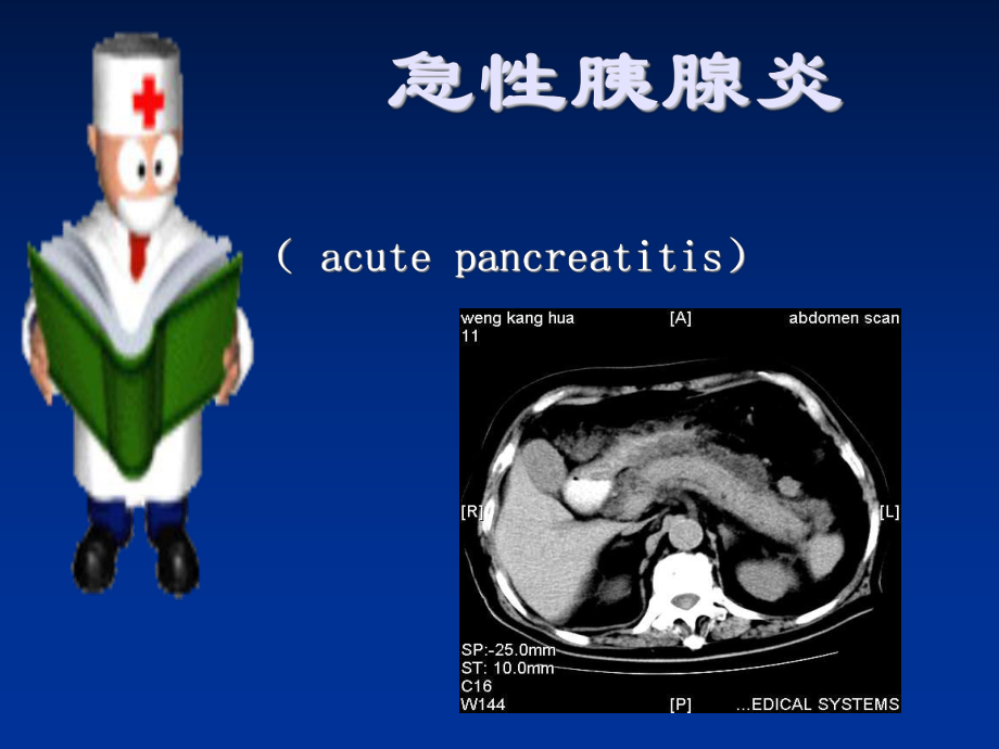 21急性胰腺炎_第1頁