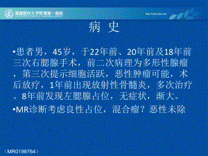 涎腺粘液表皮樣癌的影像診斷講座培訓(xùn)課件PPT