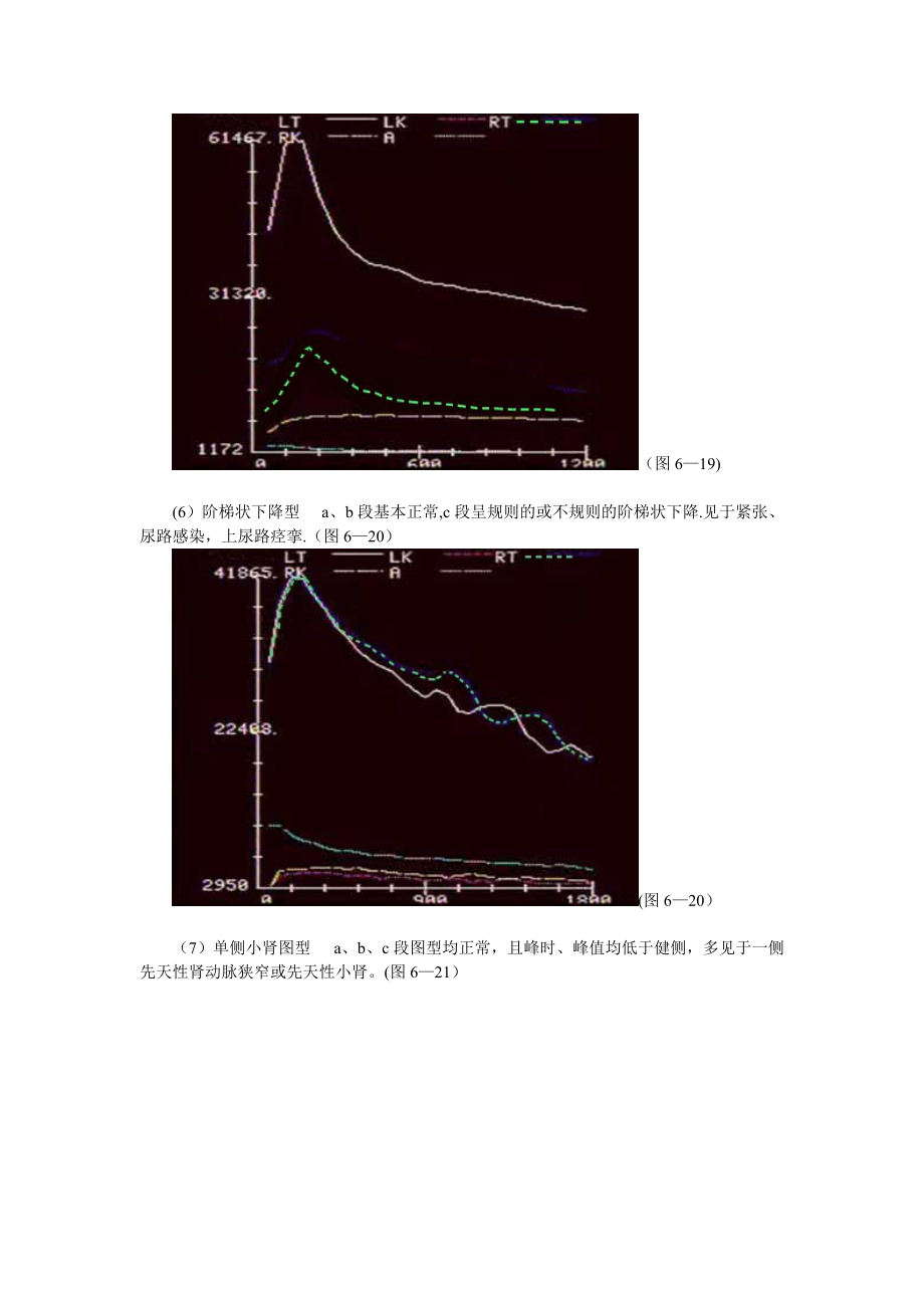 常见肾图及其临床意义图片