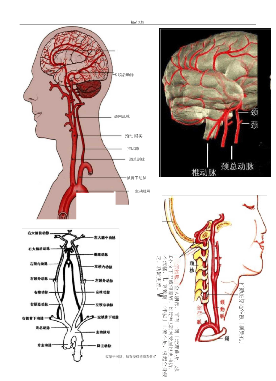 脑供血及脑血管解剖图文演示教学