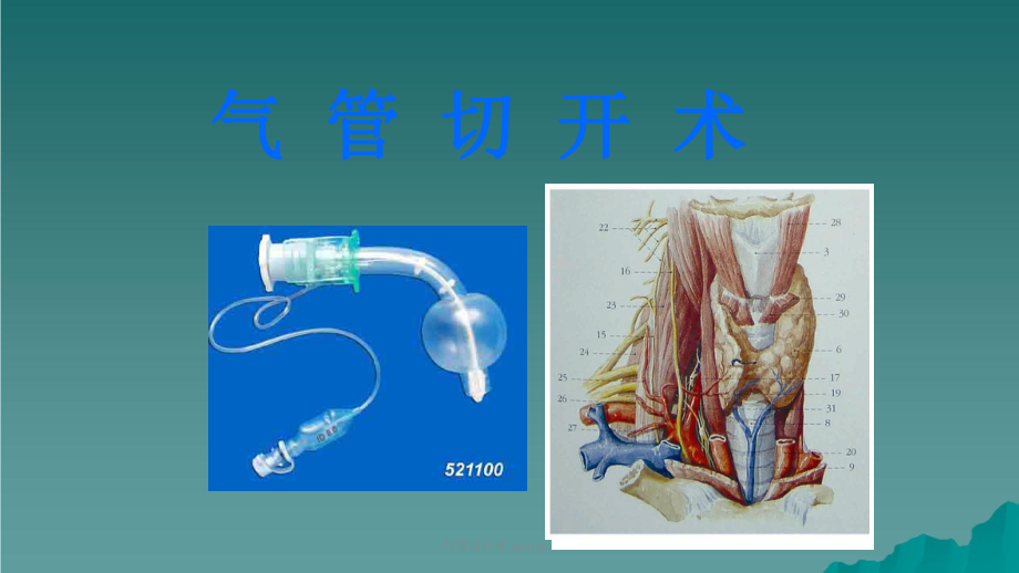 经皮气管切开术ppt图片