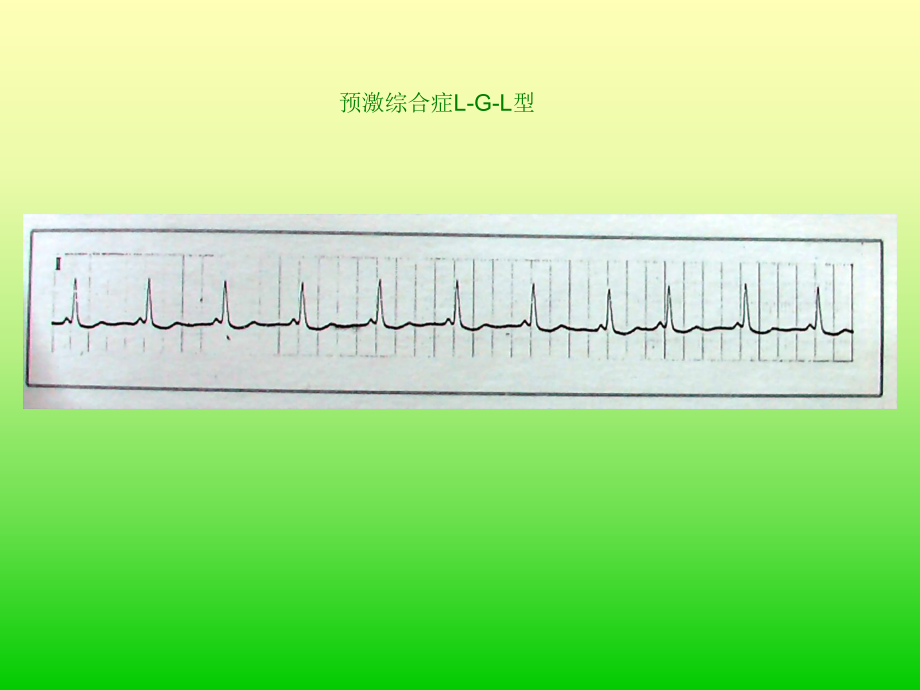 临床执业医师技能考试心电图及影像考试题答案PPT课件02_第1页