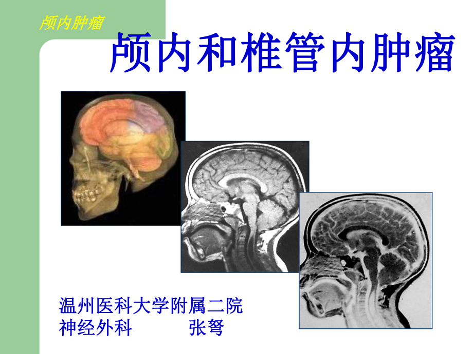 【外科學(xué)ppt課件】顱內(nèi)腫瘤及顱內(nèi)椎管腫瘤血管性疾病_第1頁