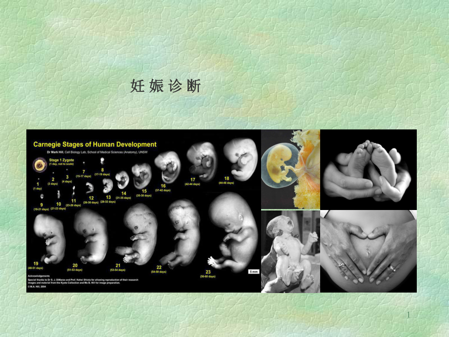 中西医结合妊娠诊断_第1页
